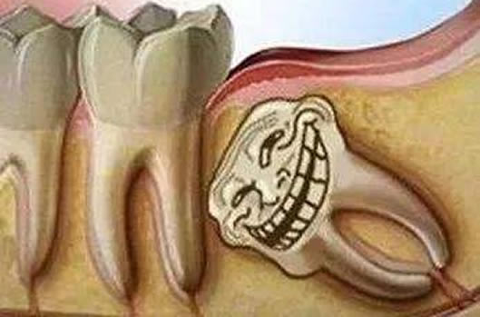 拔智齿后悔死了：智齿拔掉后真的让我们后悔吗？