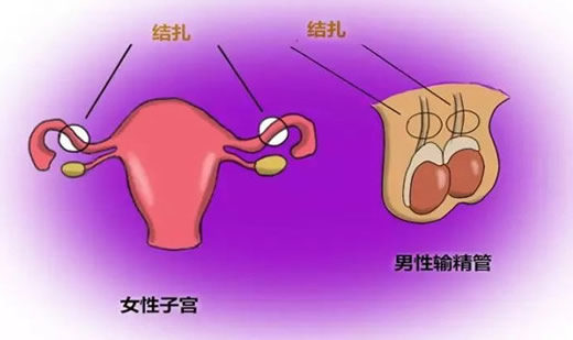女的事后避孕小妙招：女性不吃药4大避孕方法效果好