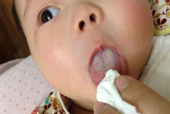 宝宝舌苔发白怎么回事？学会这几招，你也是“老中医”
