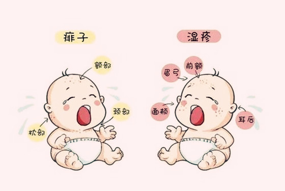 新生儿湿疹和热疹的区别在哪里 5张图片教你读懂