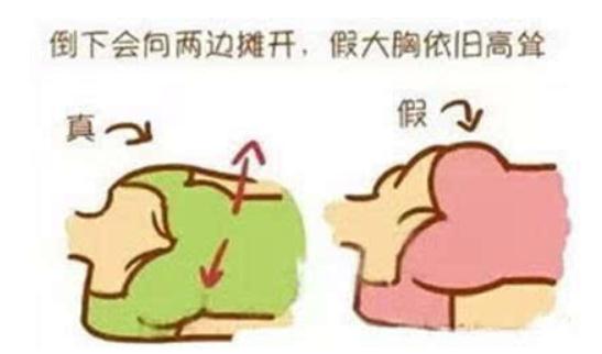 隆过的胸和天然的胸在手感上有区别吗（网友感受）