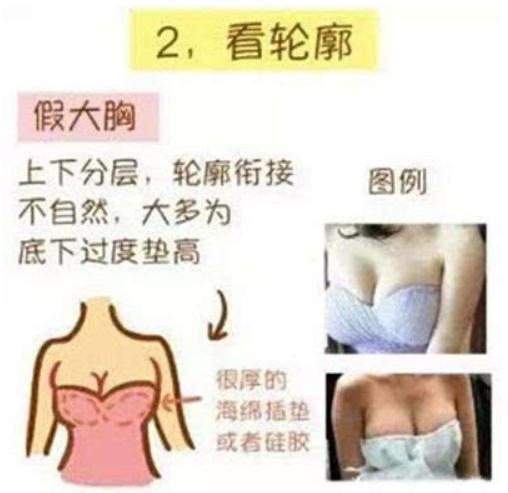 隆过的胸和天然的胸在手感上有区别吗（网友感受）