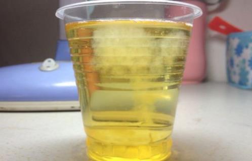 尿里撒盐看生男生女准不准：生男生女不同特征和测试方法