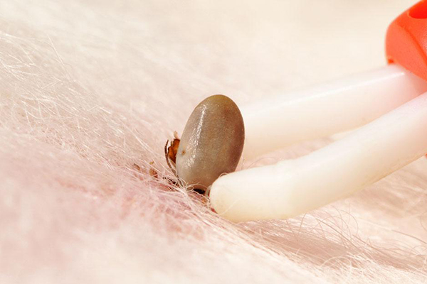 怎么判断是被蜱虫咬了 这些症状就可以确定了