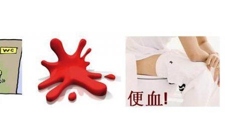 大便出鲜血是怎么回事：大便出血原因详情及怎么办