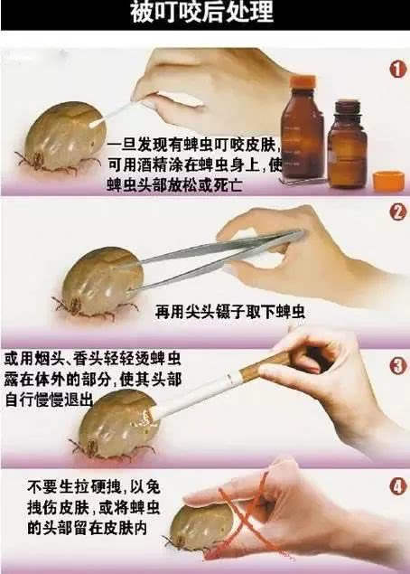 人被蜱虫叮咬后症状图片：被叮咬后别急医生教你辨别