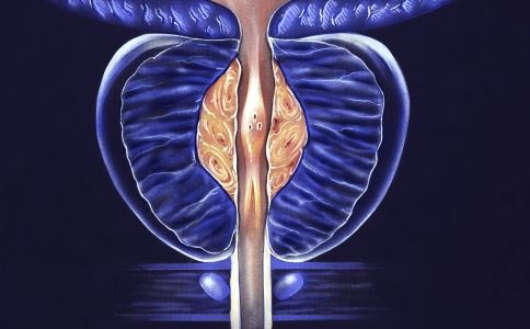 前列腺炎的5个征兆 得了一个就要重视