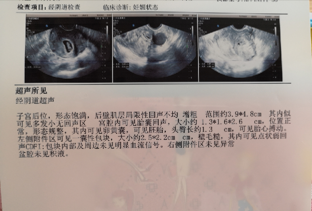 接好孕！备孕两年，终于自然怀孕，接到了自己的宝宝
