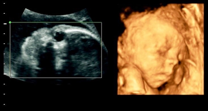 四维看是女孩最后会是男孩吗,女孩翻盘男孩的几率大不大?