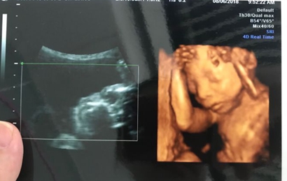 四维单上出现这四个字是怀了男宝,85%都已证实!