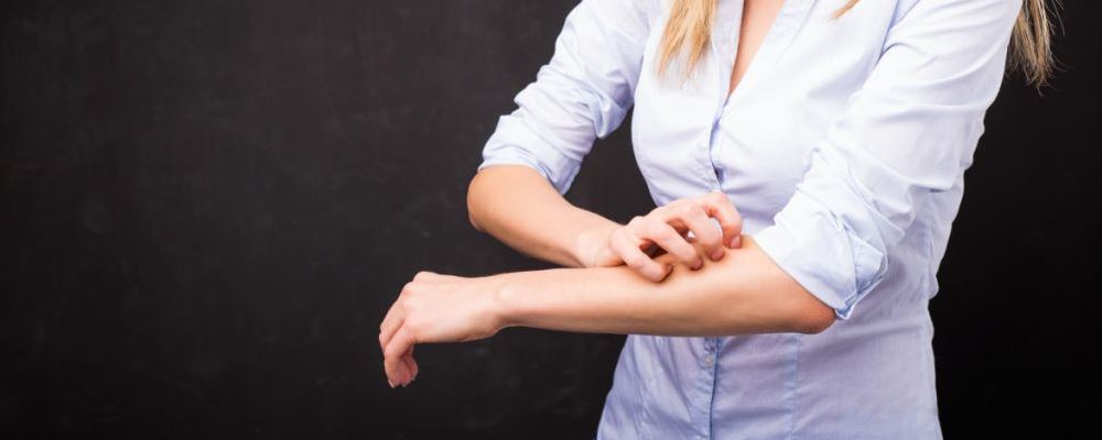 得了荨麻疹怎么办 饮食注意什么