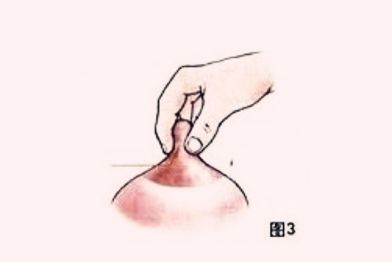 催奶按摩的手法示意图 下奶效果立竿见影