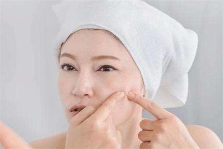 下巴长痘痘是什么原因?脸上长痘痘主要就三个原因