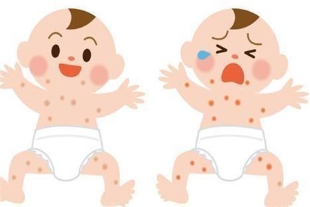 湿疹怎么引起的?宝妈应对新生儿湿疹这样做最有效