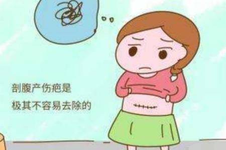 顺产好还是剖腹产好,女性剖腹产对身体有何负面影响