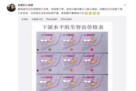 智齿一定要拔吗?智齿出现发炎肿痛时再不拔就晚了