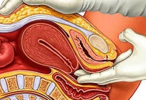 女性顺产过程中除了痛还有什么感觉?