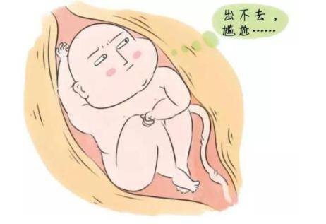 巨大胎儿跟什么有关系 胎儿过大的影响要提高警觉
