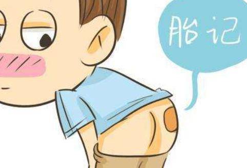 胎记是怎么形成的?怀孕期间三个行为可能会让宝宝有胎记