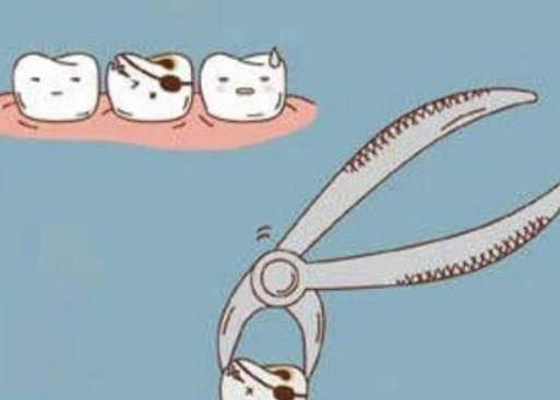 拔智齿到底有多痛？拔智齿要花多少钱