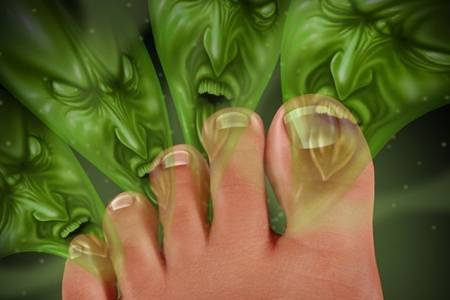 脚气的治疗方法有哪些 9种有效治疗脚气的民间土方法大全