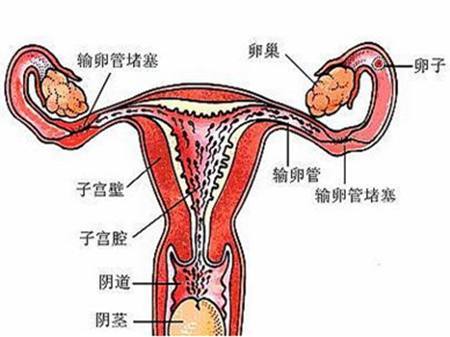 做输卵管造影到底痛不痛？哪些人适合做子宫输卵管造影检查呢？