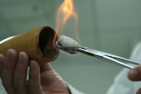 拔火罐有什么好处 拔火罐的教学方法