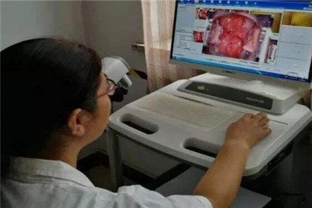 女人HPV的四个常见原因