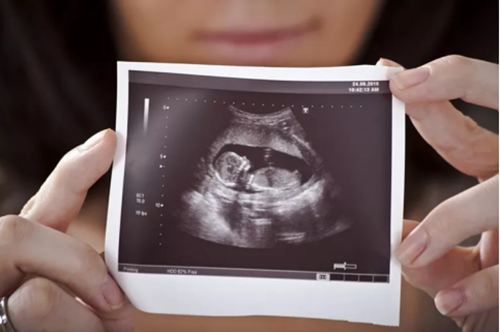 四维单子怎么看男孩女孩？3秒教你看男孩女孩！