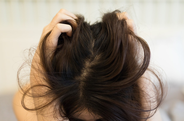 生产完之后脱发严重的几大小妙招,值得收藏