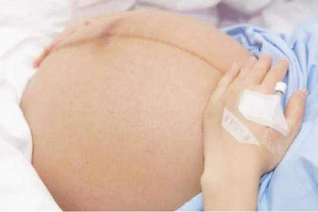 怀孕后肚子上的“黑线”是什么？妊娠中线的秘密,你有必要了解