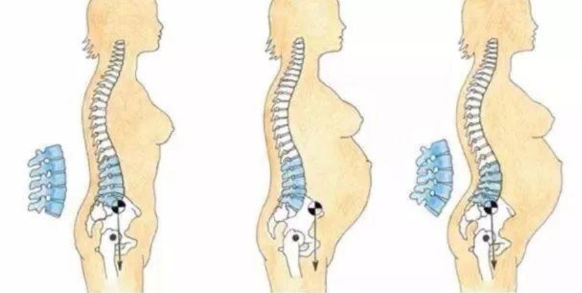 ＂10个产妇9个腰疼＂,产后为什么会腰疼？年轻妈妈一样会中招