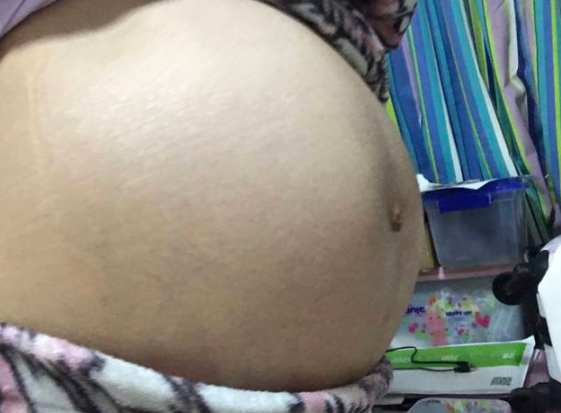 生没生过孩子,明白人一眼就能看出,这3个部位就暴露了生育史