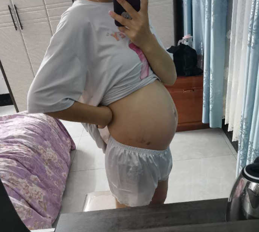 准妈妈太粗略,四维彩超胎儿不配合,这一陋习趁早改