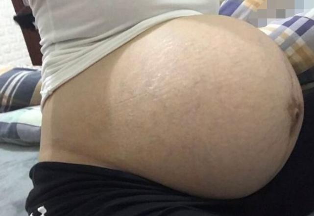 怀孕晚期,如何判断＂要生了＂？3个方法要牢记,别把孩子生家里