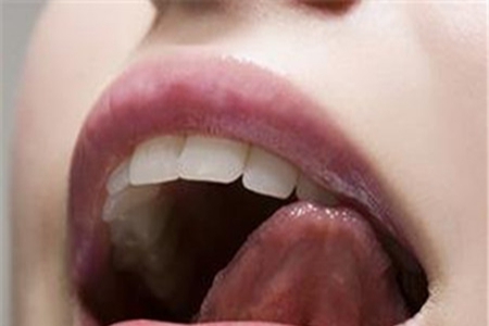 治疗口腔溃疡的方法有哪些？常年被折磨的你赶紧收藏起来