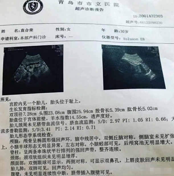 金刚芭比火了,曾被质疑不能生育,如今怀孕6个月仍坚持撸铁
