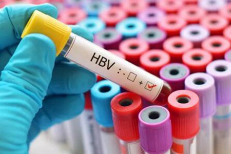 乙肝小三阳是什么意思？乙肝小三阳注意事项