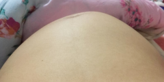 胎儿为什么总喜欢在右侧胎动?3点原因孕妇了解下,别瞎担心