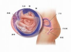 【胎位】胎位不正_胎位不正怎么办
