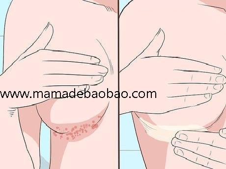 4种方法来使用凡士林（美容产品）