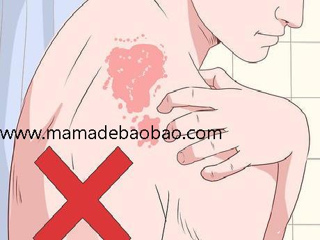 4种方法来使用凡士林（美容产品）