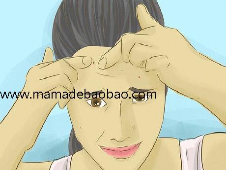 6种方法来用家庭秘方去痘印(预防青春痘和相关痘印)