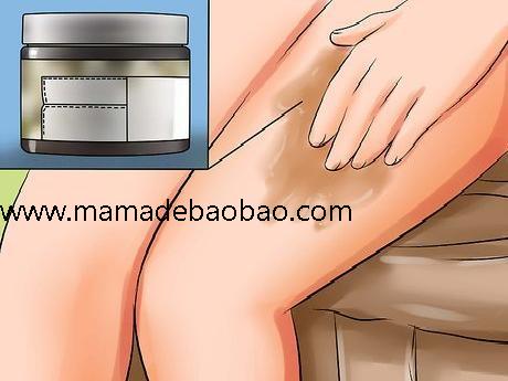 3种方法来遮住腿上的妊娠纹（使妊娠纹变浅）